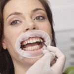 Fluoryzacja zębów – najważniejsza metoda zapobiegania próchnicy