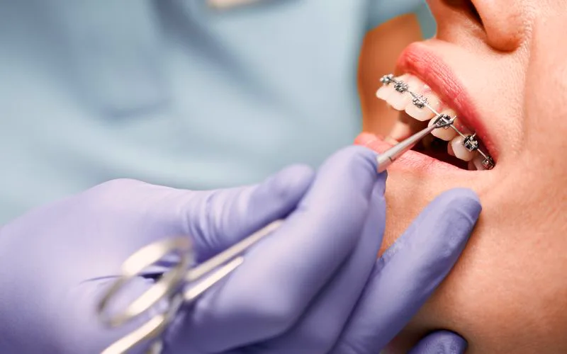 5 powodów, dla których warto wybrać ortodontę dla dziecka