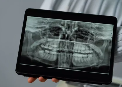 Nowoczesne zastosowania rentgenu w diagnostyce zębów
