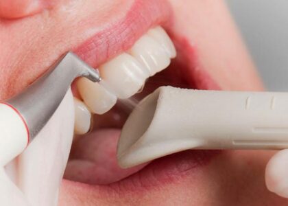 Odśwież swój uśmiech: jak piaskowanie pomaga utrzymać zęby w dobrej kondycji